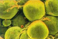 Lipocytes and connective tissue cells 