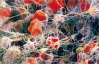 Fibrin-Eiwei&szlig;netz