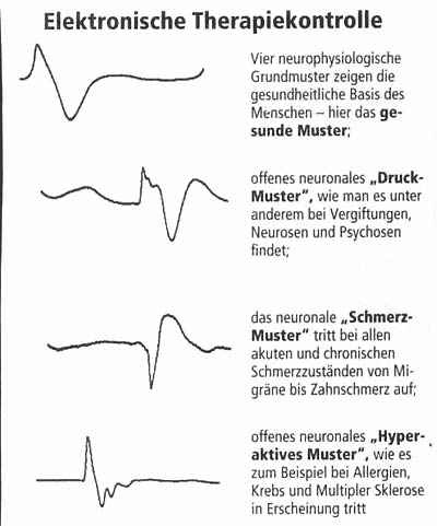 Elektronische Therapiekontrolle