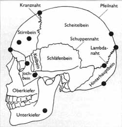 Schädelplatten