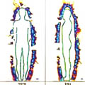 Neue Dimensionen der Diagnose